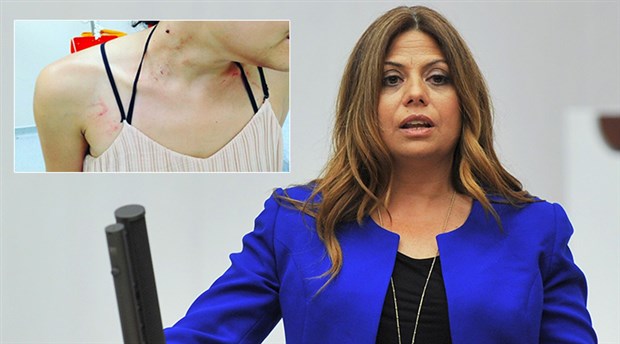 CHP’li Altıok, darp edilen müzisyen Gülşah Erol’u meclise taşıdı