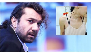 Müzisyene polis dayağına Halil Sezai'den sert tepki