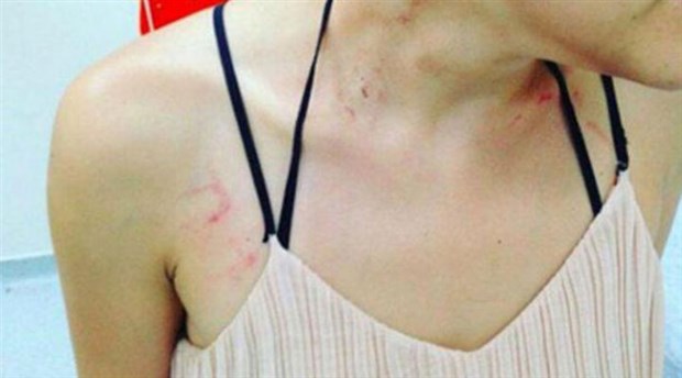 Gülşah Erol’un saldırıya uğradığı anın görüntüleri ortaya çıktı!