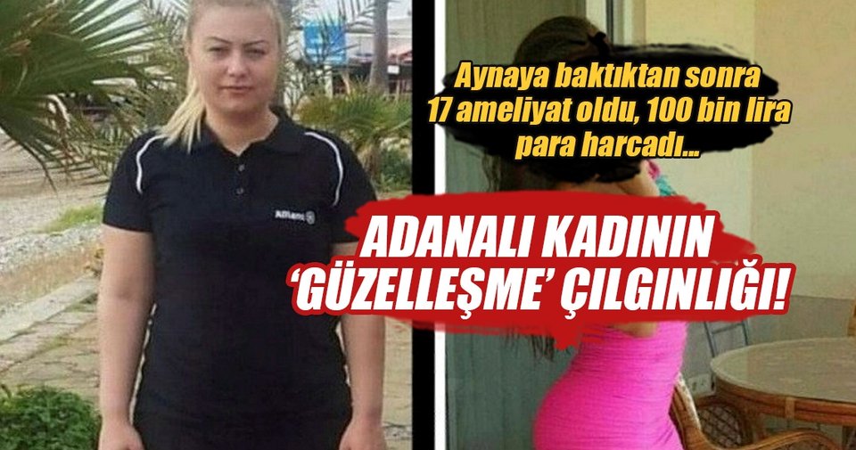Güzellik uğruna 17 kez bıçak altına yatıp 100 bin lira harcadı