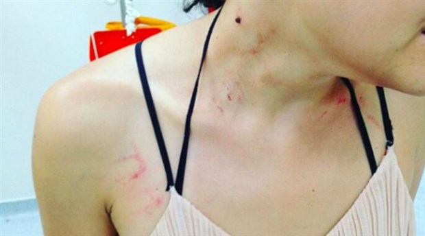 Kadıköy’de polis, bir müzisyeni ‘terörist’ diyerek darp etti