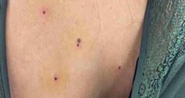 Kına eğlencesinde maganda kurşunu: 4 yaralı