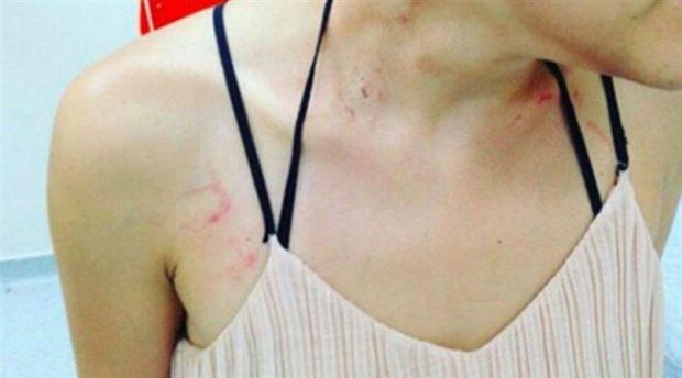 Polisin darp ettiği müzisyene ilişkin Emniyet’ten açıklama