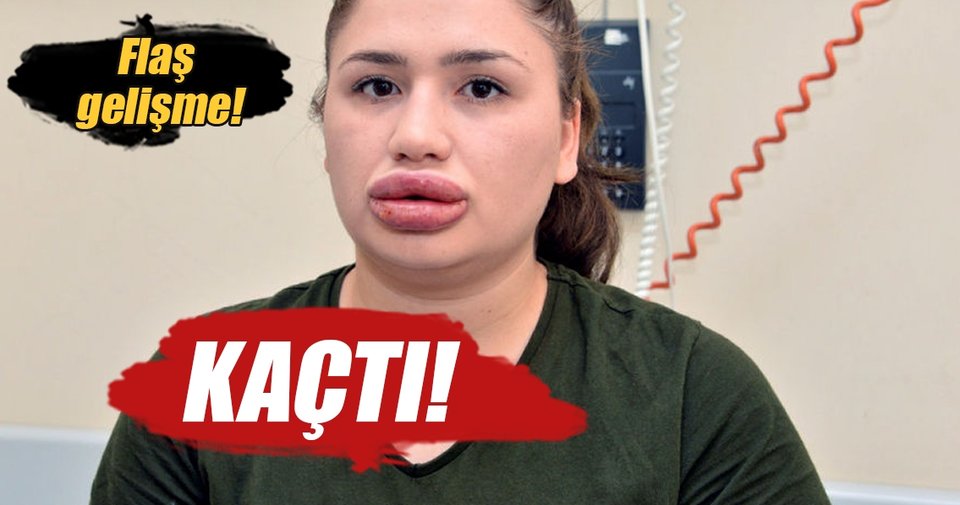 Sahte estetikçi cezaevinden kaçtı