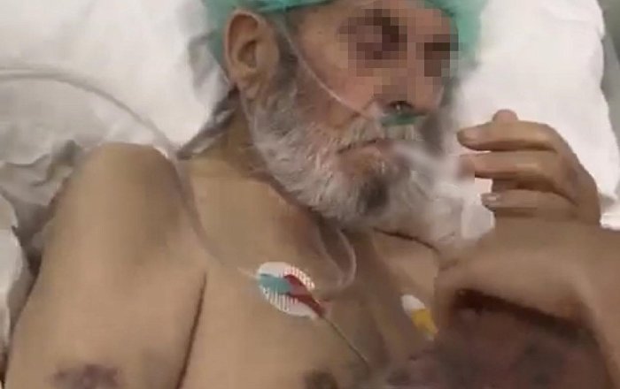 Hemşirelerin sigara verip dalga geçtiği yoğun bakım hastası hayatını kaybetmiş