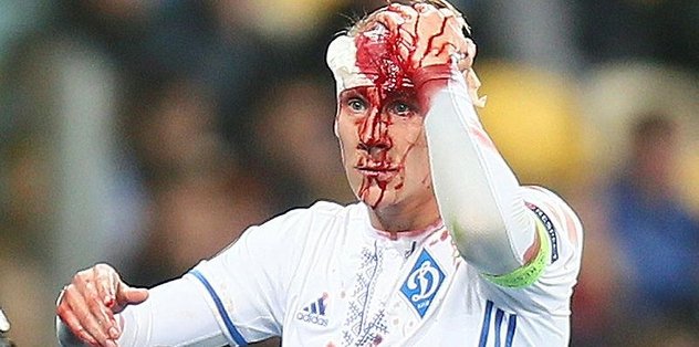 Domagoj Vida’nın sağlık durumu açıklandı