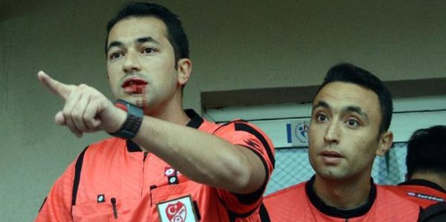 Kırmızı karta kızdı hakeme kafa attı!
