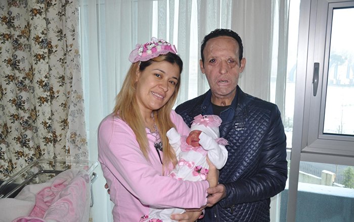 Yüz nakli yapılan Recep Sert tutuklandı