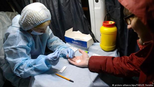 Her 17 saniyede bir kişiye HIV bulaşıyor