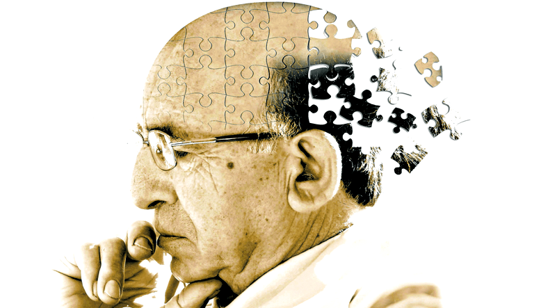Alzheimer Hastalığının Sebebi Dopamin Eksikliği mi?