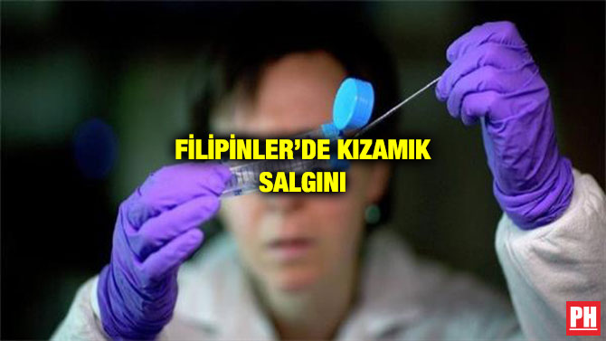 FİLİPİNLER’DE KIZAMIK SALGINI