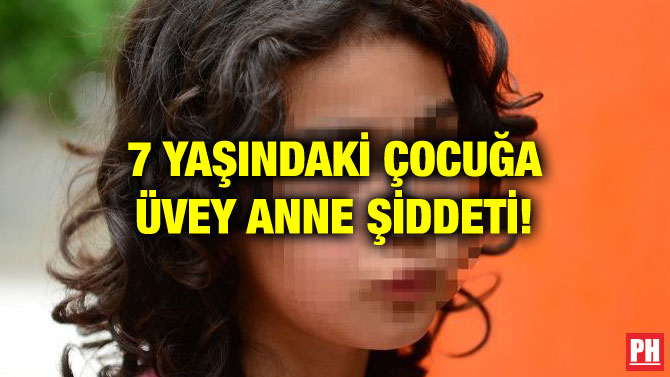 7 YAŞINDAKİ ÇOCUĞA ÜVEY ANNE ŞİDDETİ!
