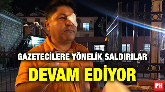 GAZETECİLERE YÖNELİK SALDIRILAR DEVAM EDİYOR