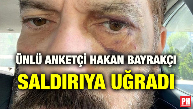 ÜNLÜ ANKETÇİ HAKAN BAYRAKÇI SALDIRIYA UĞRADI