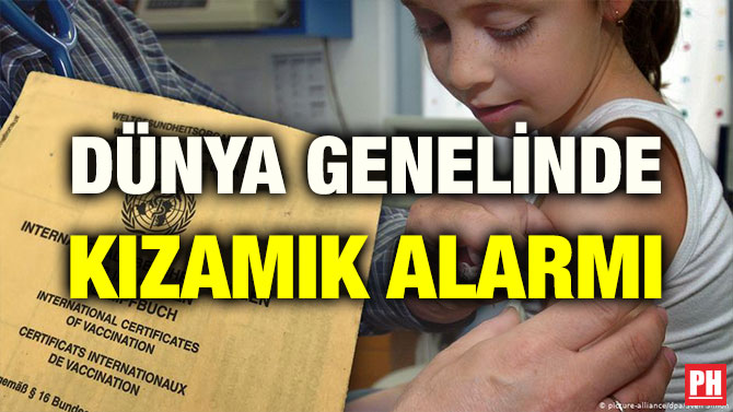 DÜNYA GENELİNDE KIZAMIK ALARMI