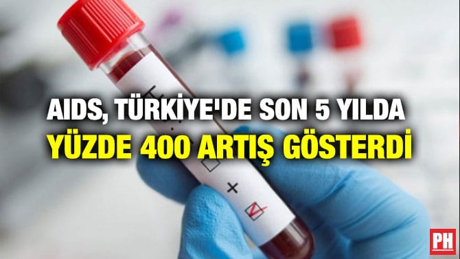AIDS, TÜRKİYE’DE SON 5 YILDA  YÜZDE 400 ARTIŞ GÖSTERDİ
