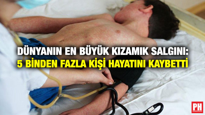 DÜNYANIN EN BÜYÜK KIZAMIK SALGINI: 5 BİNDEN FAZLA KİŞİ HAYATINI KAYBETTİ