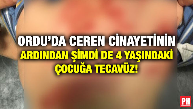 ORDU’DA CEREN CİNAYETİNİN ARDINDAN ŞİMDİ DE 4 YAŞINDAKİ ÇOCUĞA TECAVÜZ!