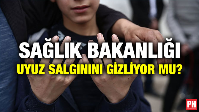SAĞLIK BAKANLIĞI UYUZ SALGININI GİZLİYOR MU?