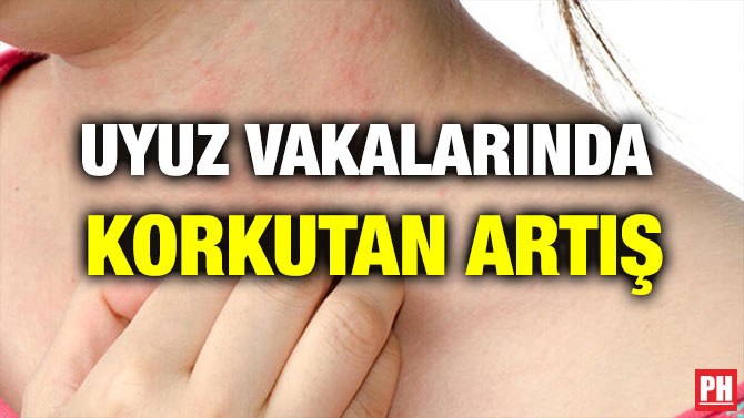UYUZ VAKALARINDA  KORKUTAN ARTIŞ