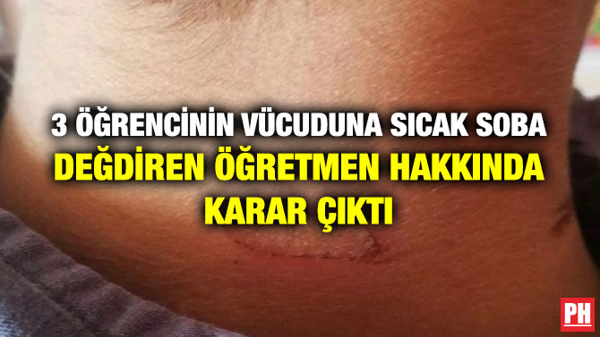 3 ÖĞRENCİNİN VÜCUDUNA SICAK SOBA DEĞDİREN ÖĞRETMEN HAKKINDA KARAR ÇIKTI