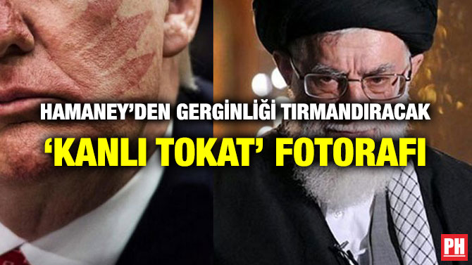 HAMANEY’DEN GERGİNLİĞİ TIRMANDIRACAK ‘KANLI TOKAT’ FOTORAFI