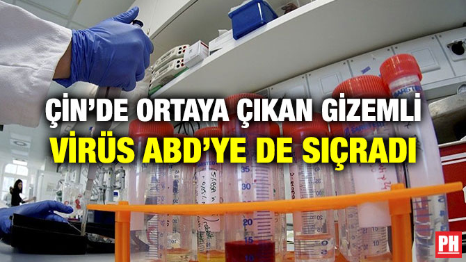 ÇİN’DE ORTAYA ÇIKAN GİZEMLİ VİRÜS ABD’YE DE SIÇRADI