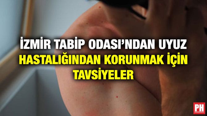 İZMİR TABİP ODASI’NDAN UYUZ HASTALIĞINDAN KORUNMAK İÇİN TAVSİYELER