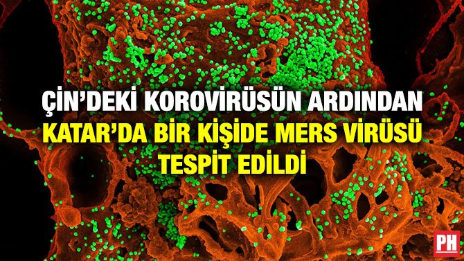 ÇİN’DEKİ KOROVİRÜSÜN ARDINDAN KATAR’DA BİR KİŞİDE MERS VİRÜSÜ TESPİT EDİLDİ