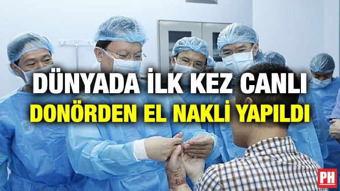 DÜNYADA İLK KEZ CANLI DONÖRDEN EL NAKLİ YAPILDI