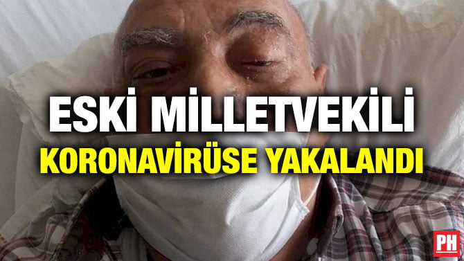 ESKİ MİLLETVEKİLİ KORONAVİRÜSE YAKALANDI