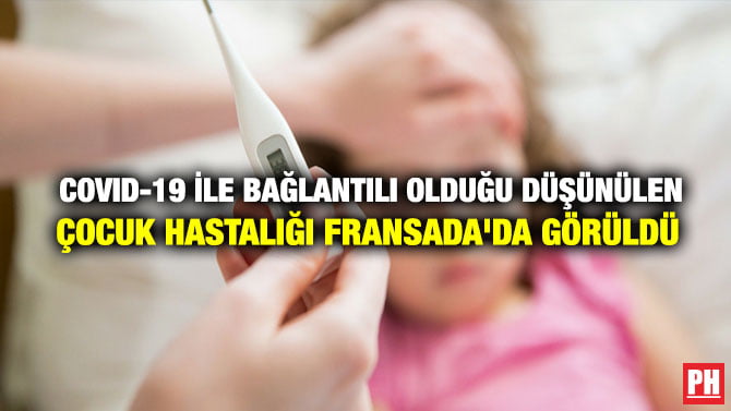 COVID-19 İLE BAĞLANTILI OLDUĞU DÜŞÜNÜLEN ÇOCUK HASTALIĞI FRANSADA’DA GÖRÜLDÜ