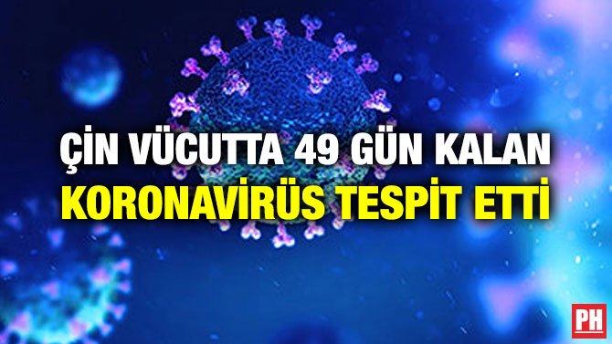 ÇİN VÜCUTTA 49 GÜN KALAN KORONAVİRÜS TESPİT ETTİ