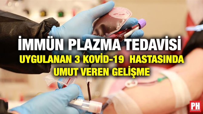 İMMÜN PLAZMA TEDAVİSİ UYGULANAN 3 KOVİD-19 HASTASINDA UMUT VEREN GELİŞME