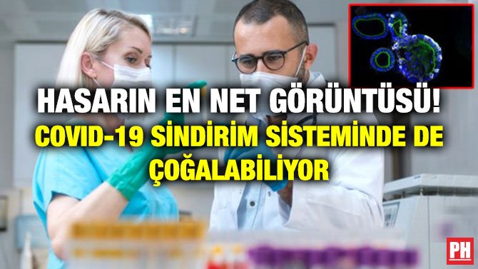 HASARIN EN NET GÖRÜNTÜSÜ! COVID-19 SİNDİRİM SİSTEMİNDE DE ÇOĞALABİLİYOR
