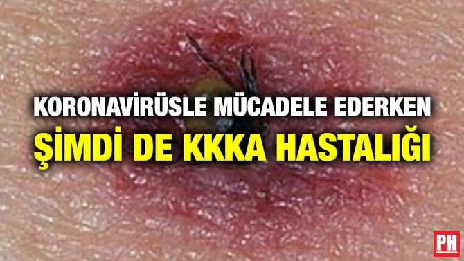KORONAVİRÜSLE MÜCADELE EDERKEN ŞİMDİ DE KKKA HASTALIĞI