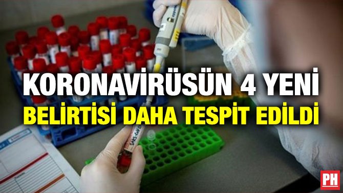 KORONAVİRÜSÜN 4 YENİ BELİRTİSİ DAHA TESPİT EDİLDİ