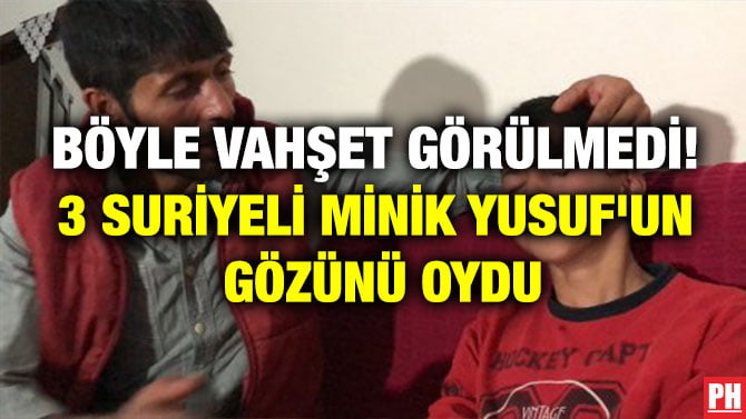 BÖYLE VAHŞET GÖRÜLMEDİ! 3 SURİYELİ MİNİK YUSUF’UN GÖZÜNÜ OYDU