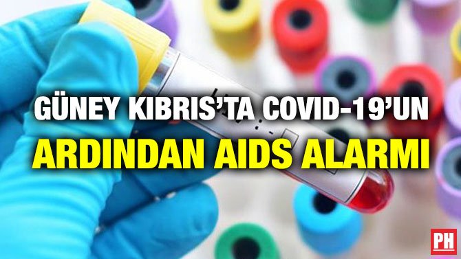 GÜNEY KIBRIS’TA COVID-19’UN ARDINDAN AIDS ALARMI