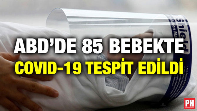 ABD’DE 85 BEBEKTE COVID-19 TESPİT EDİLDİ