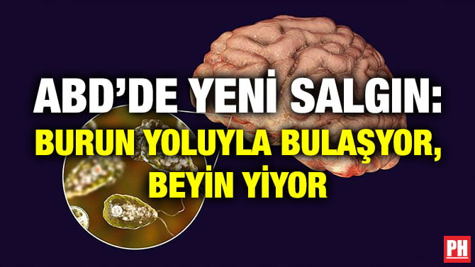 ABD’DE YENİ SALGIN: BURUN YOLUYLA BULAŞYOR, BEYİN YİYOR
