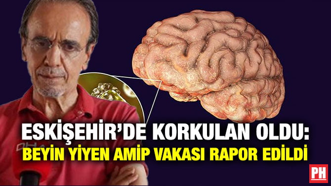 ESKİŞEHİR’DE KORKULAN OLDU: BEYİN YİYEN AMİP VAKASI RAPOR EDİLDİ