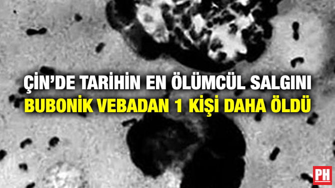 ÇİN’DE TARİHİN EN ÖLÜMCÜL SALGINI BUBONİK VEBADAN 1 KİŞİ DAHA ÖLDÜ
