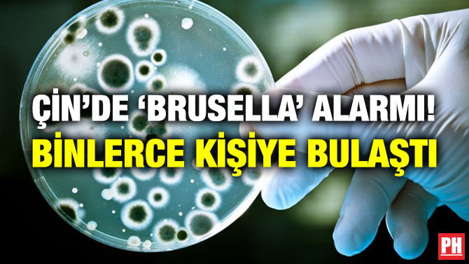 ÇİN’DE ‘BRUSELLA’ ALARMI! BİNLERCE KİŞİYE BULAŞTI