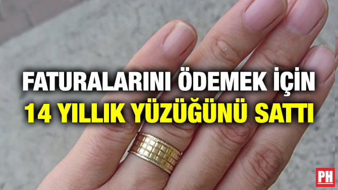 FATURALARINI ÖDEMEK İÇİN 14 YILLIK YÜZÜĞÜNÜ SATTI