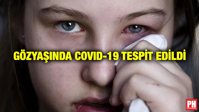 GÖZYAŞINDA COVID-19 TESPİT EDİLDİ
