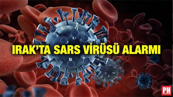IRAK’TA SARS VİRÜSÜ ALARMI