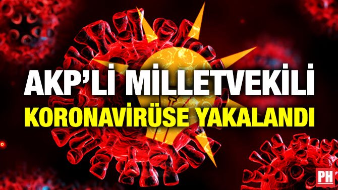 AKP’Lİ MİLLETVEKİLİ KORONAVİRÜSE YAKALANDI