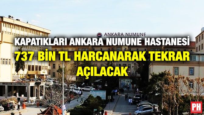 KAPATIKLARI ANKARA NUMUNE HASTANESİ 737 BİN TL HARCANARAK TEKRAR AÇILACAK