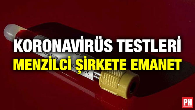 KORONAVİRÜS TESTLERİ MENZİLCİ ŞİRKETE EMANET